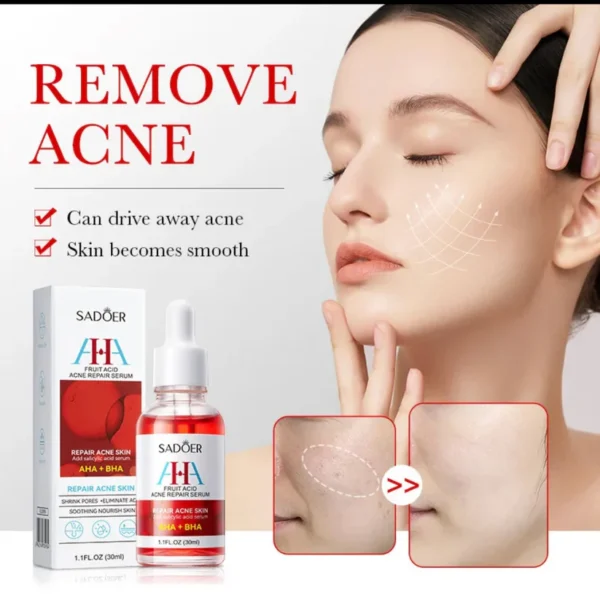 Fruit acid Acne repair serum